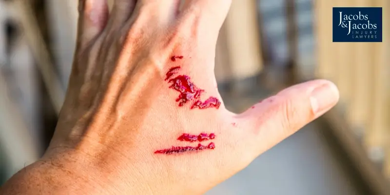 Expert Milford Dog Bite Attorney